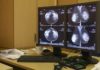 Breast Unit di Sanremo, Ats Liguria: “Il servizio proseguirĂ e sarĂ potenziato” Breast Unit Sanremo