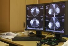 Ottobre Rosa nell’imperiese, visite e incontri sulla prevenzione: il calendario Breast Unit Sanremo