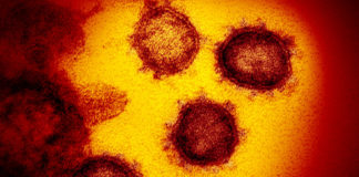 Anziana morta a Laigueglia per cause naturali. Risultata positiva al tampone del coronavirus: scatta l’isolamento dell’hotel coronavirus covid-19