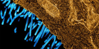 Coronavirus: paziente rientrato dalla Cina e ricoverato a Sanremo, normale stato influenzale virus influenza