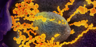 Coronavirus, salgono a 132 i casi in Liguria: 13 nel Ponente ligure coronavirus covid-19