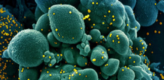 Emergenza coronavirus, salgono a 207 le persone ospedalizzate in Asl1. 2419 i positivi in Liguria coronavirus covid-19