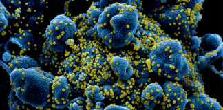 Coronavirus, superate le 4mila persone positive in Liguria coronavirus covid-19