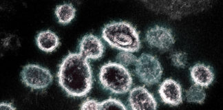 Coronavirus, deceduto questa notte un paziente di 87 anni coronavirus covid-19