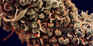 Coronavirus: 31 nuovi casi in provincia di Imperia, 16 decessi in Liguria nel bollettino odierno coronavirus covid-19