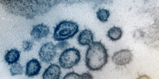 Coronavirus: 328 nuovi casi in Liguria, 12 i decessi coronavirus covid-19