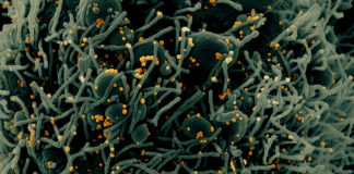 Covid: 76 nuovi positivi in Liguria, 11 in Asl1 coronavirus covid-19