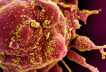 La lettera dell’alpinista Stefano Sciandra: “Mio padre positivo all’Orengo Demora, non ho sue notizie da due giorni” coronavirus covid-19