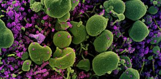 Coronavirus: 25 decessi nel bollettino odierno in Liguria, calano gli ospedalizzati in Asl1 coronavirus covid-19