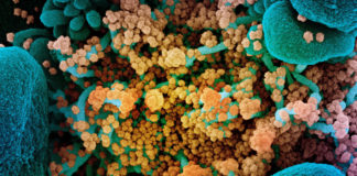 Covid: oltre 5.700 nuovi casi positivi in Liguria, 9 i decessi coronavirus covid-19