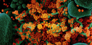 Covid: 1.026 nuovi casi positivi in Liguria, 6 decessi coronavirus covid-19