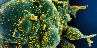 Coronavirus: 1.209 i nuovi positivi in Liguria, 118 in Asl1 coronavirus covid-19