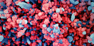 Covid: 315 nuovi casi positivi in Liguria, 37 in provincia di Imperia coronavirus covid-19