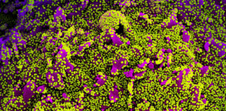 Covid, continua il calo dei positivi in Liguria: 1.925 nuovi casi. 4 decessi coronavirus covid-19