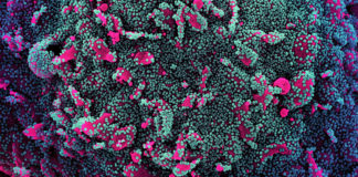 Covid: 610 nuovi casi positivi in Liguria, crescono gli ospedalizzati, 6 decessi coronavirus covid-19