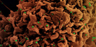 Covid: 372 nuovi casi positivi in provincia di Imperia, due decessi all’ospedale di Sanremo coronavirus covid-19