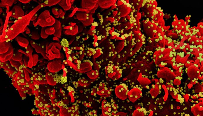 coronavirus covid-19
