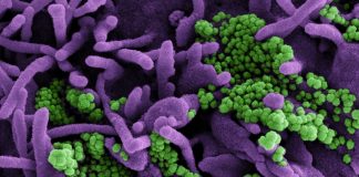 Covid: oltre 1.500 nuovi casi positivi in Liguria, un decesso coronavirus covid-19