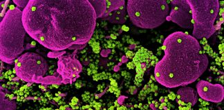 Covid: 818 nuovi casi positivi in Liguria, un decesso coronavirus covid-19