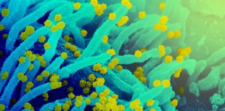 Covid, in arrivo in Liguria l’anticorpo monoclonale ‘Sotrovimab’ coronavirus covid-19