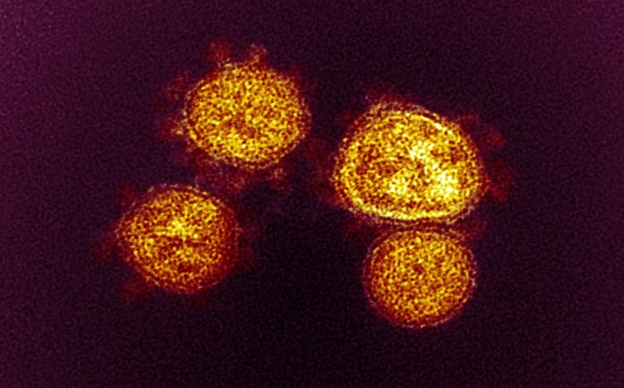 coronavirus covid-19