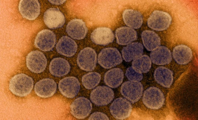 coronavirus covid-19
