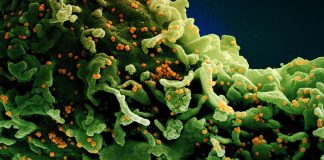 Covid: in Liguria oltre 1.500 nuovi casi positivi, un decesso all’ospedale di Sanremo coronavirus covid-19