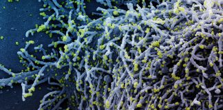 Covid: oltre 1.500 nuovi casi positivi in Liguria, un decesso all’ospedale di Sanremo coronavirus covid-19