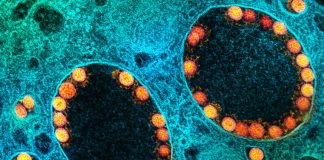 Covid: 615 nuovi casi positivi in Liguria, un decesso a Sanremo coronavirus covid-19