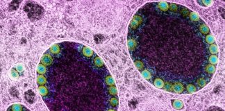 Covid: crescono i ricoveri in Liguria, 8 decessi coronavirus covid-19