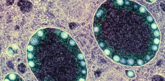 Covid: 1.137 nuovi casi positivi in Liguria, 7 decessi. Gli ospedalizzati scendono sotto la soglia dei 400 coronavirus covid-19