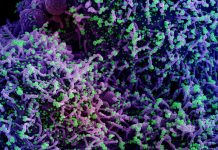 Covid: i dati del contagio di oggi, 517 i nuovi positivi coronavirus covid-19