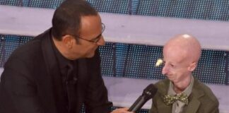 Addio a Sammy Basso, il malato di progeria più longevo al mondo. Carlo Conti: “Nel Festival di Sanremo 2015 ci insegnò cosa vuol dire vivere” Sammy Basso